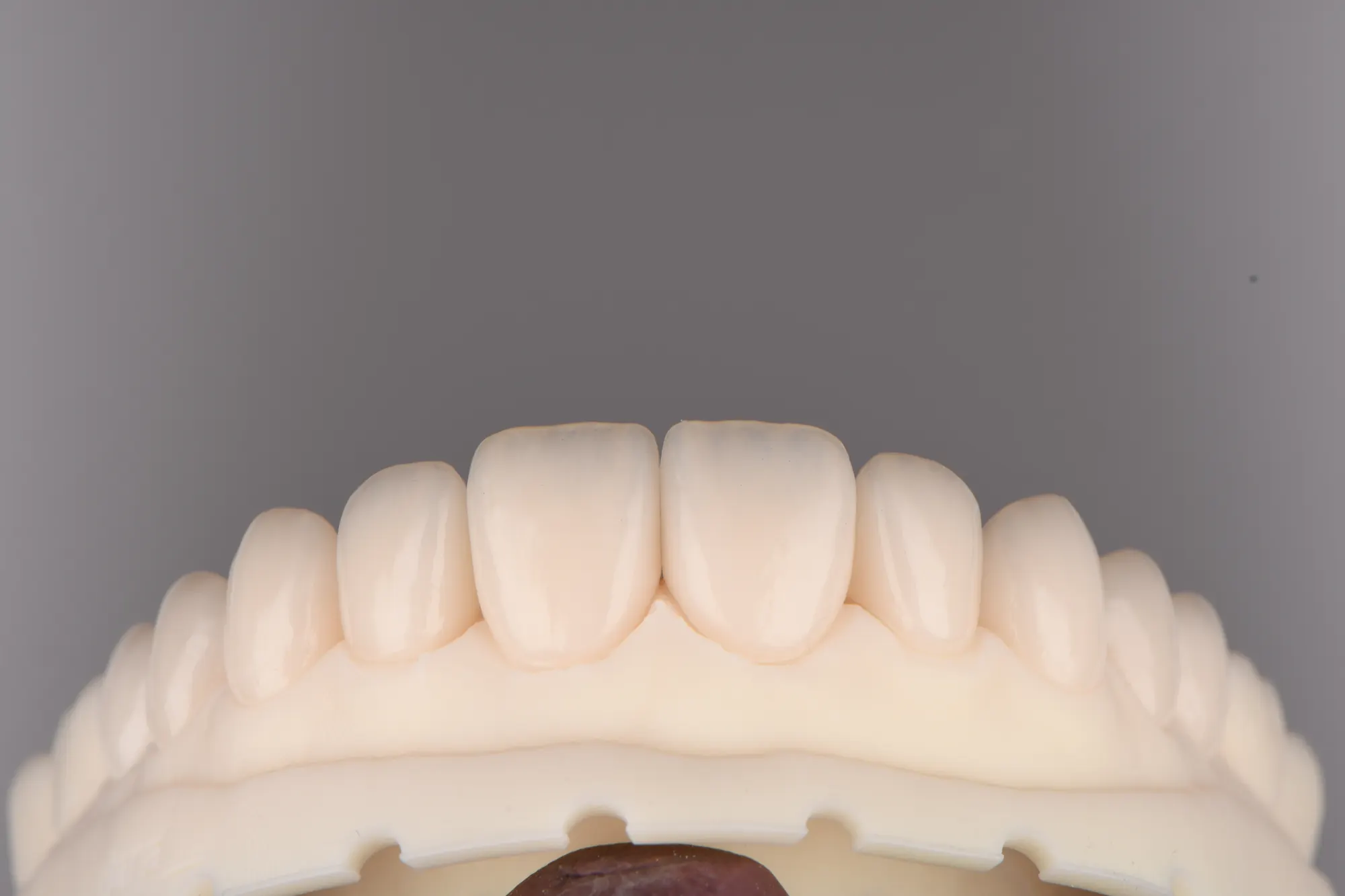Full-arch ceramic restoration on a working model