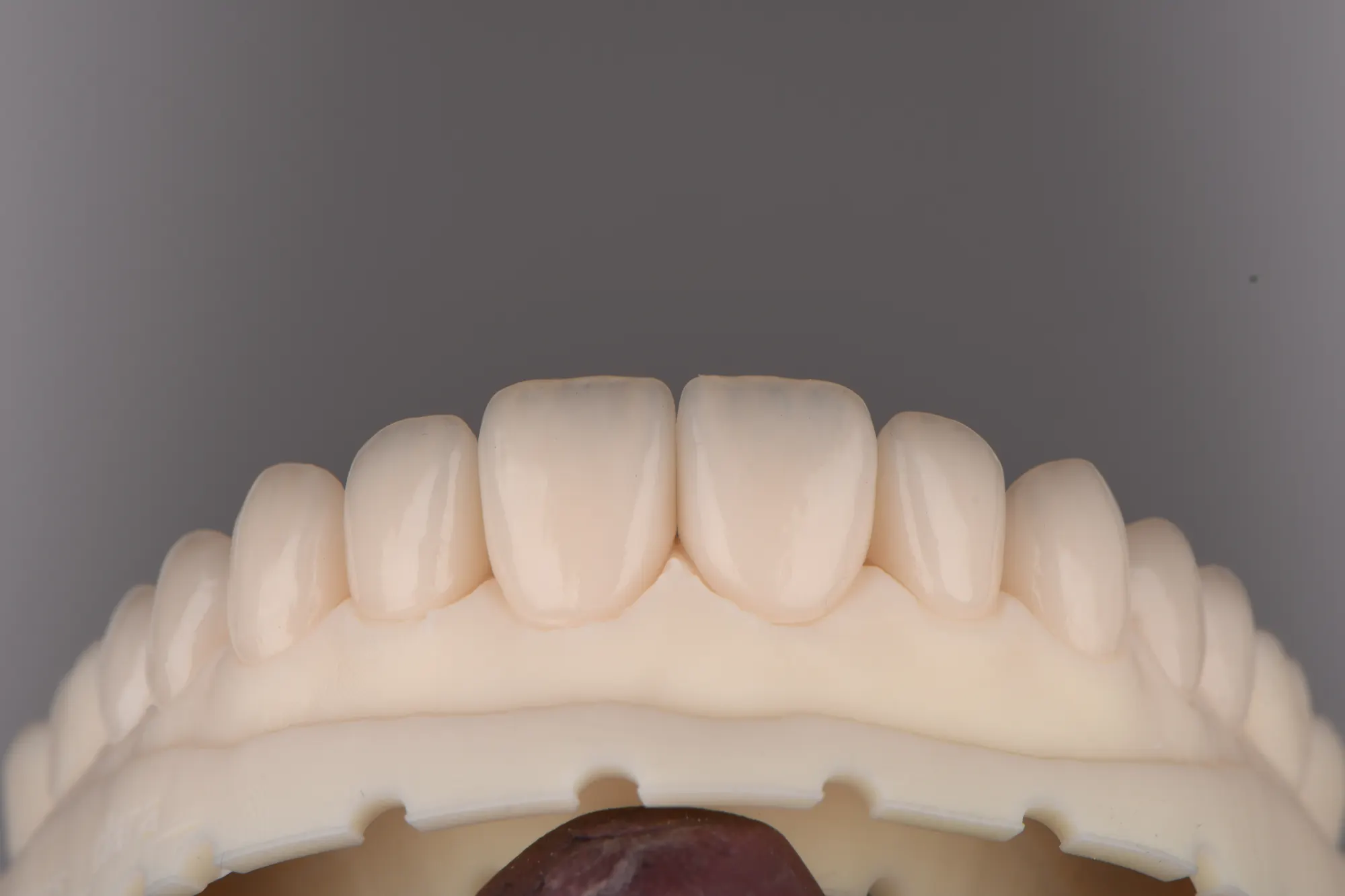 Detail of a full-arch ceramic restoration showing surface texture