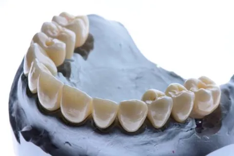 Full-arch working model with removable dies