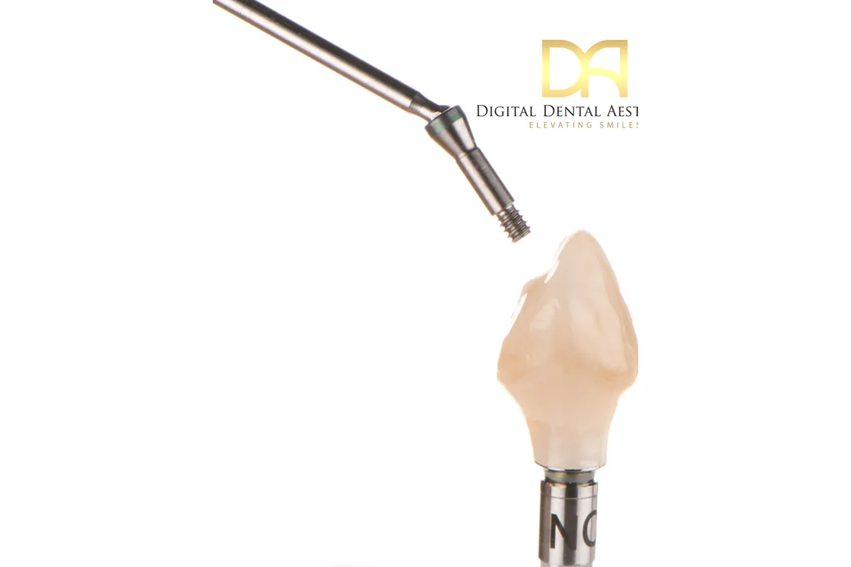 A ceramic implant abutment held under the light