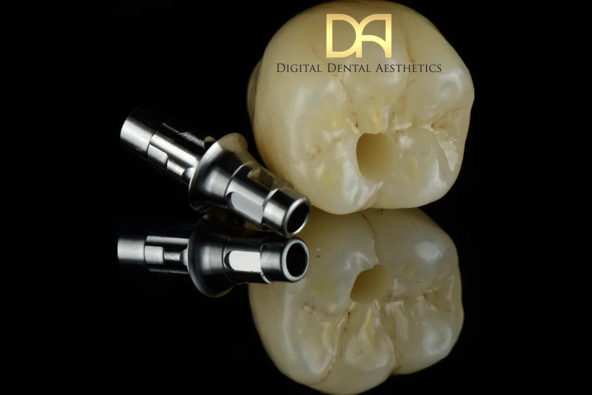 Two implant crowns photographed beside their abutments and screws