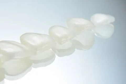 Monolithic posterior ceramic bridge