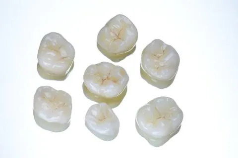 A set of six posterior ceramic crowns