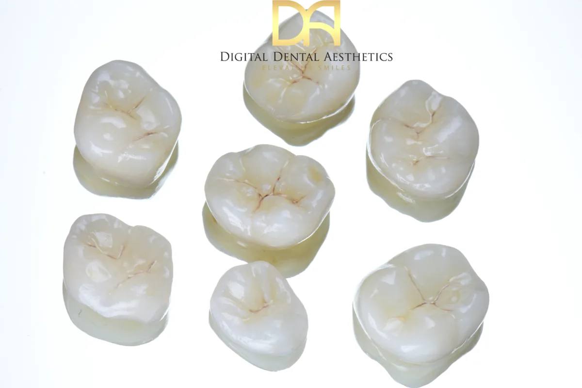 A set of posterior crowns laid out on a white ground before seating