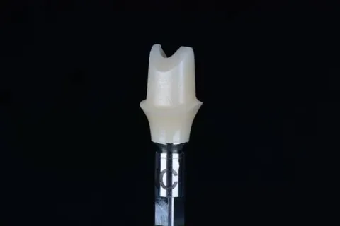 Internal surface of a prepared ceramic crown