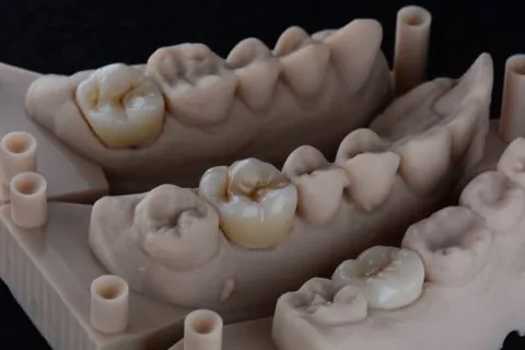 Articulated working model with prepared dies